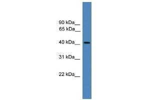 Western Blotting (WB) image for anti-Proteasome (Prosome, Macropain) 26S Subunit, ATPase, 6 (PSMC6) (C-Term) antibody (ABIN2788038)