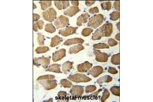 hCG_1645727 Antibody (C-term) (ABIN656073 and ABIN2845421) immunohistochemistry analysis in formalin fixed and paraffin embedded human skeletal muscle followed by peroxidase conjugation of the secondary antibody and DAB staining. (KBTBD13 Antikörper  (C-Term))