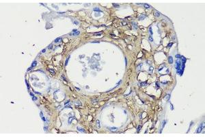 Immunohistochemistry of paraffin-embedded Human placenta using Decorin Polyclonal Antibody at dilution of 1:200 (40x lens). (Decorin Antikörper)