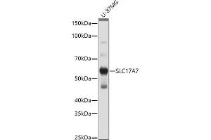 Western blot analysis of extracts of U-87MG cells, using SLC17 antibody (ABIN6127303, ABIN6147863, ABIN6147864 and ABIN6216671) at 1:1000 dilution. (SLC17A7 Antikörper  (AA 461-560))