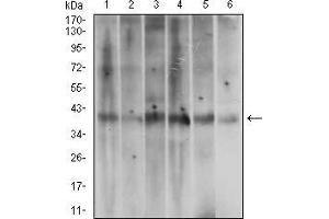 Fig. (ACP5 Antikörper  (AA 221-325))
