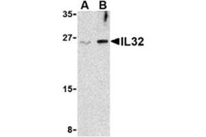 Image no. 1 for anti-Interleukin 32 (IL32) (Middle Region) antibody (ABIN318795) (IL32 Antikörper  (Middle Region))