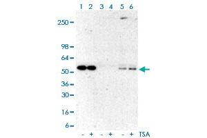 Immunoprecipitation analysis of Lane 1: A431 cell whole lysates, Lane 2: TSA-treated A431 cell whole lysates; Lane 3: A431 cell whole lysates, Lane 4: TSA-treated A431 cell whole lysates using rabbit IgG antibody; Lane 5: A431 cell whole lysates, Lane 6: TSA-treated A431 cell whole lysates using Acetylated-Lysine monoclonal antibody, clone RM101  at 1:500 dilution. (Acetylated Lysine Antikörper  (acetylated))