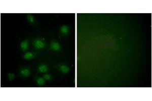 Immunofluorescence analysis of HuvEc cells, using NIFK (Phospho-Thr234) Antibody.