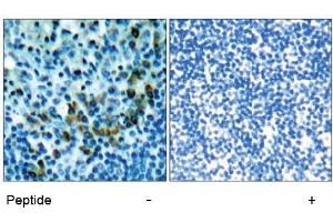 Image no. 1 for anti-zeta-Chain (TCR) Associated Protein Kinase 70kDa (ZAP70) (Tyr319) antibody (ABIN197384) (ZAP70 Antikörper  (Tyr319))