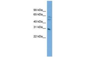 Image no. 1 for anti-mRNA Turnover 4 Homolog (MRTO4) (AA 143-192) antibody (ABIN6744820) (C1orf33 Antikörper  (AA 143-192))
