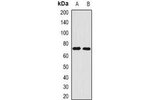 Western blot analysis of Angiomotin expression in A431 (A), M21 (B) whole cell lysates. (Angiomotin Antikörper)