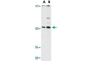 Western blot analysis of MATN3 in NIH/3T3 cell lysate with MATN3 polyclonal antibody  at (A) 1 and (B) 2 ug/mL . (Matrilin 3 Antikörper  (C-Term))