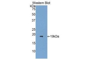 Western Blotting (WB) image for anti-Retinol Binding Protein 7, Cellular (RBP7) (AA 1-134) antibody (ABIN1860420)