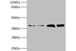 Western blot All lanes: TBCC antibody at 2 μg/mL Lane 1: Hela whole cell lysate Lane 2: HepG2 whole cell lysate Lane 3: A549 whole cell lysate Lane 4: MCF-7 whole cell lysate Secondary Goat polyclonal to rabbit IgG at 1/10000 dilution Predicted band size: 40 kDa Observed band size: 40 kDa (TBCC Antikörper  (AA 2-346))