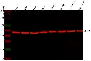 Western blot analysis of eIF4A2 using anti-eIF4A2 antibody (ABIN3043426).