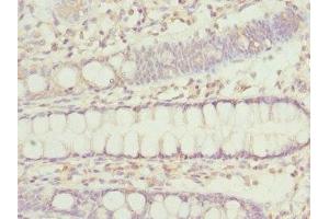 Immunohistochemistry of paraffin-embedded human colon tissue using ABIN7156305 at dilution of 1:100 (IP6K2 Antikörper  (AA 1-180))