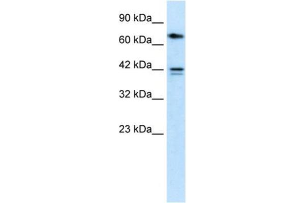 CACNB1 Antikörper  (N-Term)