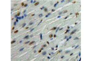 Used in DAB staining on fromalin fixed paraffin-embedded Heart tissue (NUP133 Antikörper  (AA 36-240))