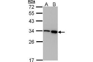 WB Image Sample (30 ug of whole cell lysate) A: 293T B: A431 , 12% SDS PAGE antibody diluted at 1:1000 (RPA2 Antikörper)