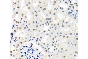 Immunohistochemistry of paraffin-embedded Mouse kidney using THOC1 Polyclonal Antibody at dilution of 1:100 (40x lens). (THOC1 Antikörper)