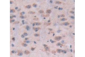 IHC-P analysis of Kidney tissue, with DAB staining. (POMT1 Antikörper  (AA 318-513))