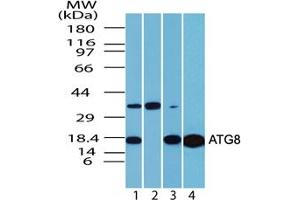 ATG8 Western Blot. (LC3B Antikörper  (N-Term))