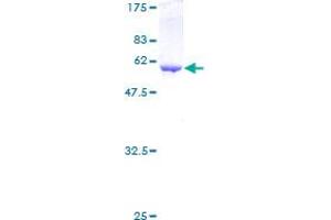 Image no. 1 for Annexin A5 (ANXA5) (AA 1-320) protein (GST tag) (ABIN1345194)