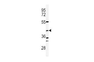 Western Blotting (WB) image for anti-DNA Fragmentation Factor, 40kDa, beta Polypeptide (Caspase-Activated DNase) (DFFB) (AA 1-30), (N-Term) antibody (ABIN653798)