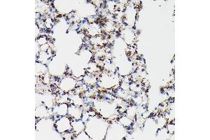 Immunohistochemistry of paraffin-embedded mouse lung using SFTP Rabbit pAb (ABIN3017436, ABIN3017437, ABIN3017438 and ABIN6220091) at dilution of 1:50 (40x lens). (Surfactant Protein A1 Antikörper)