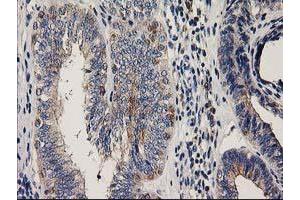 Image no. 1 for anti-Coiled-Coil-Helix-Coiled-Coil-Helix Domain Containing 5 (CHCHD5) antibody (ABIN1497488) (CHCHD5 Antikörper)