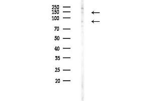 anti-Interleukin 4 Receptor (IL4R) (pTyr497) antibody