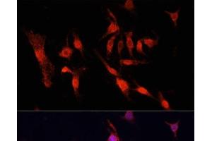 Immunofluorescence analysis of PC12 cells using EGFR Polyclonal Antibody at dilution of 1:100. (EGFR Antikörper)