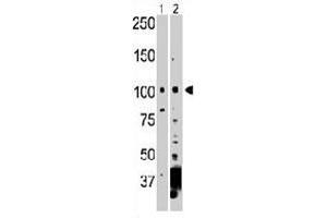 The NEK9 polyclonal antibody  is used in Western blot to detect NEK9 in 293 cell lysate (Lane 1) and mouse heart tissue lysate (Lane 2) . (NEK9 Antikörper  (C-Term))