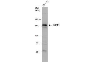 WB Image ENPP1 antibody detects ENPP1 protein by western blot analysis. (ENPP1 Antikörper)
