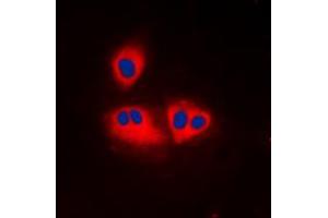Immunofluorescent analysis of ACOT2 staining in K562 cells.