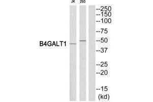 Western blot analysis of extracts from Jurkat/293 cells, using B4GALT1 antibody. (B4GALT1 Antikörper  (C-Term))