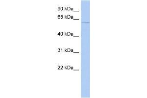 WB Suggested Anti-CHRNA3 Antibody Titration: 0. (CHRNA3 Antikörper  (N-Term))