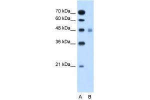 SLC17A4 antibody used at 1 ug/ml to detect target protein. (SLC17A4 Antikörper)
