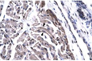 Immunohistochemistry (IHC) image for anti-TAF15 RNA Polymerase II, TATA Box Binding Protein (TBP)-Associated Factor, 68kDa (TAF15) (N-Term) antibody (ABIN2779283)