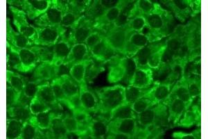 Immunocytochemistry/Immunofluorescence analysis using Mouse Anti-Hsp90 Monoclonal Antibody, Clone 4F3. (HSP90 Antikörper)