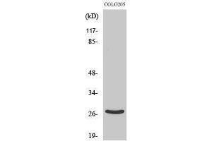 Western Blotting (WB) image for anti-Dehydrogenase/reductase (SDR Family) Member 2 (DHRS2) (Internal Region) antibody (ABIN3184307)