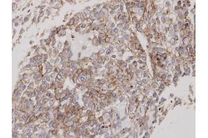 Immunohistochemistry (IHC) image for anti-Flotillin 2 (FLOT2) (C-Term) antibody (ABIN2854687)