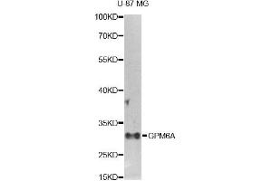 Western blot analysis of extracts of U-87MG cells, using GPM6A antibody. (GPM6A Antikörper)