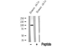 Western blot analysis of extracts of Human skin? (TRPV1 Antikörper  (C-Term))