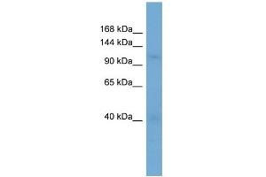 WB Suggested Anti-RANBP5 Antibody Titration: 0. (Importin 5 Antikörper  (N-Term))