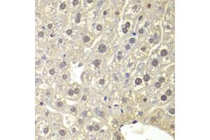 Immunohistochemistry of paraffin-embedded mouse liver using NR3C1 antibody (ABIN5971191) at dilution of 1/200 (40x lens). (Glucocorticoid Receptor Antikörper)