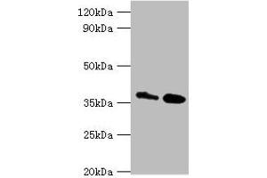 Western blot All lanes: CTSK antibody at 8 μg/mL Lane 1: MCF-7 whole cell lysate Lane 2: Rat brain tissue Secondary Goat polyclonal to rabbit IgG at 1/10000 dilution Predicted band size: 37 kDa Observed band size: 37 kDa (Cathepsin K Antikörper  (AA 115-329))