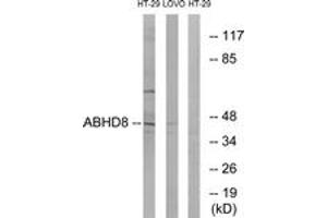 Western blot analysis of extracts from HT-29/LOVO cells, using ABHD8 Antibody. (ABHD8 Antikörper  (AA 291-340))