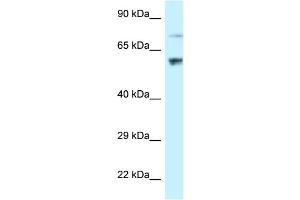 WB Suggested Anti-RSL1D1 Antibody Titration: 1. (RSL1D1 Antikörper  (C-Term))