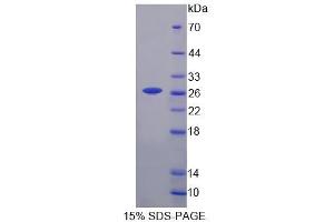 SDS-PAGE analysis of Mouse CASQ Protein.