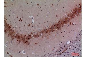 Immunohistochemistry (IHC) analysis of paraffin-embedded Rat Brain, antibody was diluted at 1:100. (Cullin 4B Antikörper  (Internal Region))