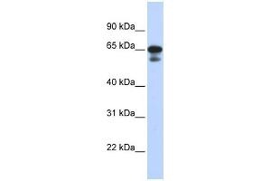 WB Suggested Anti-MIZF Antibody Titration:  0. (HINFP Antikörper  (Middle Region))