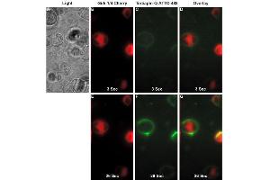 Tertiapin-Q-ATTO Fluor-488 binds GIRK1/4-Cherry transfected HEK293T cells. (Tertiapin Q peptide (Atto 488))