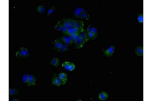 Immunofluorescent analysis of MCF-7 cells using ABIN7169856 at dilution of 1:100 and Alexa Fluor 488-congugated AffiniPure Goat Anti-Rabbit IgG(H+L) (SMIM19 Antikörper  (AA 44-107))